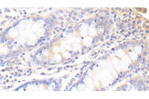 Detection of SNX9 in Human Colon Tissue using Polyclonal Antibody to Sorting Nexin 9 (SNX9)