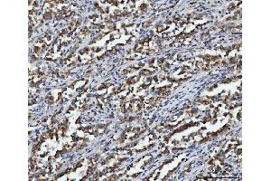 IHC analysis of Aconitase 2 using anti-Aconitase 2 antibody (ABIN7602770). (ACO2 Antikörper  (C-Term))
