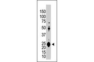 The UCHL1 polyclonal antibody  is used in Western blot to detect UCHL1 in Jurkat cell lysate.