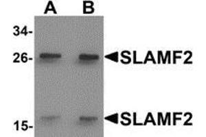 Western blot analysis of SLAMF2 in rat lung tissue lysate with SLAMF2 antibody at (A) 1 and (B) 2 μg/ml. (CD48 Antikörper  (Center))