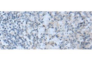 Immunohistochemistry of paraffin-embedded Human tonsil tissue using STARD4 Polyclonal Antibody at dilution of 1:50(x200) (STARD4 Antikörper)