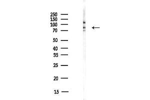 Western blot analysis of lysates from COLO205 cells(heat-shock,45 min treatment), using MLH1 Antibody at 1/1000 dilution.