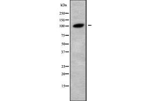 Western blot analysis Glucosidase II alpha using LOVO whole cell lysates (GANAB Antikörper  (Internal Region))