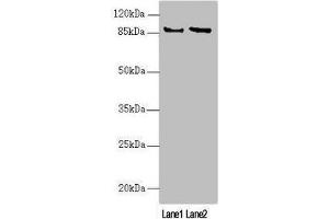 Western blot All lanes: MAPK8IP2 antibody at 2. (IB2 Antikörper  (AA 470-570))