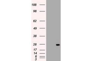 Image no. 3 for anti-Interleukin 6 (IL6) (AA 29-212) antibody (ABIN1491342) (IL-6 Antikörper  (AA 29-212))