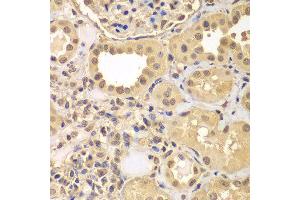 Immunohistochemistry of paraffin-embedded human kidney using ARNT2 antibody at dilution of 1:100 (x40 lens).