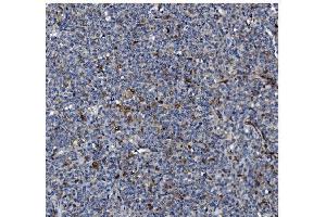 anti-Gasdermin D (GSDMD) (AA 1-484) antibody