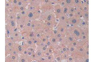 DAB staining on IHC-P; Samples: Human Liver Tissue (RNASE13 Antikörper  (AA 20-156))