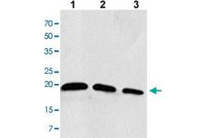 Western blot analysis of the extracts of Jurkat cells Lane 1: 30 ug, Lane 2: 20 ug, Lane 3: 10 ug with RAC2 monoclonal antibody, clone AT2G11  at 1:1000 dilution. (RAC2 Antikörper  (AA 1-189))