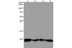 Western Blot analysis of 293T and hela cell, Mouse lung and brain tissue using HMGB3 Polyclonal Antibody at dilution of 1:400 (HMGB3 Antikörper)