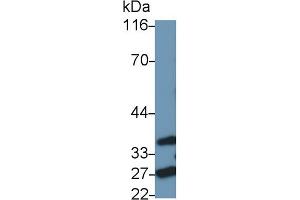 Detection of FADD in Rat Spleen lysate using Polyclonal Antibody to Fas Associating Death Domain Containing Protein (FADD) (FADD Antikörper  (AA 7-178))