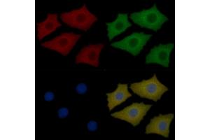 Prestin Mouse Monoclonal Antibody staining Hela cells by IF/ICC. (SLC26A5 Antikörper  (Internal Region))