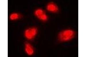 Immunofluorescent analysis of SPHK1 staining in Hela cells. (SPHK1 Antikörper)