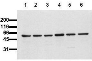 Western Blotting (WB) image for anti-V-Akt Murine Thymoma Viral Oncogene Homolog 1 (AKT1) (AA 466-480) antibody (ABIN126858) (AKT1 Antikörper  (AA 466-480))