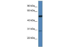 Western Blot showing IDS antibody used at a concentration of 1 ug/ml against Hela Cell Lysate (IDS Antikörper  (N-Term))