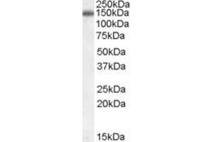 Western Blotting (WB) image for anti-Cartilage Intermediate Layer Protein, Nucleotide Pyrophosphohydrolase (CILP) (Internal Region) antibody (ABIN2465532)