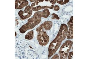 Immunohistochemical staining (Formalin-fixed paraffin-embedded sections) of human kidney with SLC22A2 monoclonal antibody, clone CL0631  shows strong immunoreactivity in renal tubules. (SLC22A2 Antikörper)