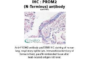 Image no. 2 for anti-Prominin 2 (PROM2) (N-Term) antibody (ABIN1738405) (Prominin 2 Antikörper  (N-Term))