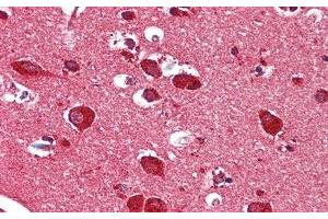 Detection of HEXb in Human Cerebrum Tissue using Polyclonal Antibody to Hexosaminidase B Beta (HEXb)