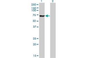 Western Blot analysis of SWAP70 expression in transfected 293T cell line by SWAP70 monoclonal antibody (M09), clone 3H8.