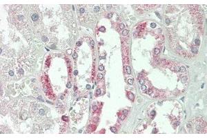 Detection of JAG1 in Human Kidney Tissue using Polyclonal Antibody to Jagged 1 (JAG1) (JAG1 Antikörper  (AA 836-1047))