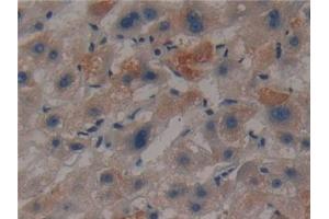 Immunohistochemistry (IHC) image for anti-Creatine Kinase, Mitochondrial 1A (CKMT1A) (AA 41-250) antibody (ABIN7431470)