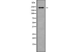 Western blot analysis of PTPRB using HuvEc whole cell lysates (PTPRB Antikörper  (N-Term))
