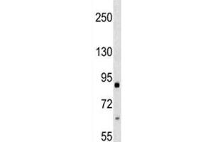 Integrin beta 2 antibody western blot analysis in 293 lysate.