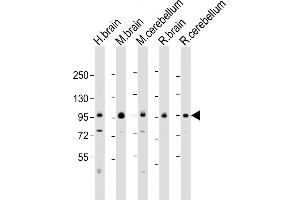 All lanes : Anti-DLG4 Antibody (C-erm) at 1:2000 dilution Lane 1: human brain lysate Lane 2: mouse brain lysate Lane 3: mouse cerebellum lysate Lane 4: rat brain lysate Lane 5: rat cerebellum lysate Lysates/proteins at 20 μg per lane. (DLG4 Antikörper  (AA 548-579))