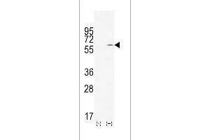 Western blot analysis of TIEG using rabbit polyclonal TIEG Antibody using 293 cell lysates (2 ug/lane) either nontransfected (Lane 1) or transiently transfected (Lane 2) with the TIEG gene.