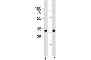 Western blot analysis of lysate from 1) HepG2 and 2) Y79 cell line using OTX2 antibody at 1:1000. (OTX2 Antikörper  (C-Term))