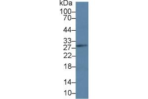 Western Blot; Sample: Mouse Lymph node lysate; Primary Ab: 3µg/ml Rabbit Anti-Human LAT Antibody Second Ab: 0. (LAT Antikörper  (AA 25-221))