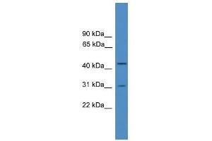 Western Blot showing OTUD6A antibody used at a concentration of 1-2 ug/ml to detect its target protein. (OTUD6A Antikörper  (Middle Region))