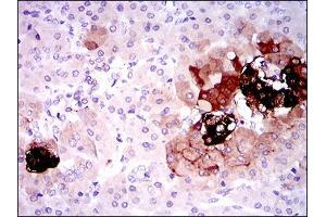 Immunohistochemical analysis of paraffin-embedded pancreas tissues using SST mouse mAb with DAB staining. (Somatostatin Antikörper  (AA 1-116))