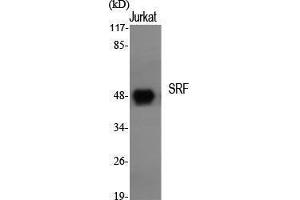 Western Blotting (WB) image for anti-Serum Response Factor (SRF) (Tyr118) antibody (ABIN3187054) (SRF Antikörper  (Tyr118))
