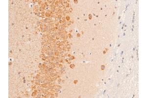 Immunohistochemistry (IHC) image for anti-Transforming Growth Factor, beta 1 (TGFB1) (C-Term) antibody (ABIN6266431)