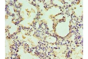 Immunohistochemistry of paraffin-embedded human lung tissue using ABIN7151443 at dilution of 1:100 (EGLN1 Antikörper  (AA 301-426))