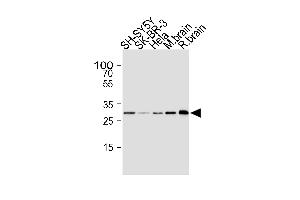 Western blot analysis of lysates from SH-SY5Y, SK-BR-3, Hela cell line, mouse brain and rat brain tissue lysate(from left to right), using CDK5 Antibody (ABIN1945087 and ABIN2843647). (CDK5 Antikörper)