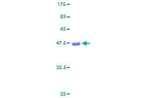 FTL Protein (AA 1-175) (GST tag)