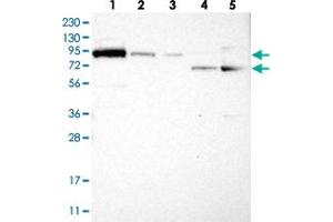 Western blot analysis of Lane 1: RT-4, Lane 2: U-251 MG, Lane 3: Human Plasma, Lane 4: Liver, Lane 5: Tonsil with FAM129B polyclonal antibody . (MEG3 Antikörper)
