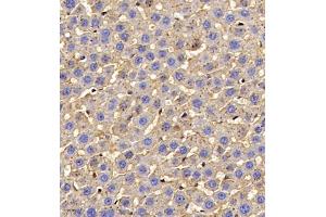 Immunohistochemistry of paraffin embedded rat liver using AHSG (ABIN7073021) at dilution of 1:700 (400x lens) (Fetuin A Antikörper)