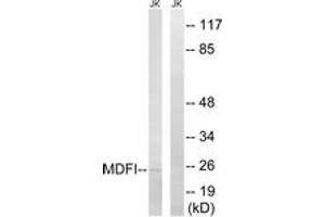 Western blot analysis of extracts from Jurkat cells, using MDFI Antibody. (MDFI Antikörper  (AA 103-152))