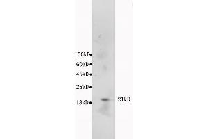 L1 mouse cerebrum lysates, probed: Anti-Bax (ABIN725375) at 1:300 in 4 °C. (BAX Antikörper  (AA 84-175))