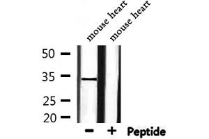 Western blot analysis of extracts from mouse heart, using HP1gamma Antibody. (CBX3 Antikörper  (Internal Region))