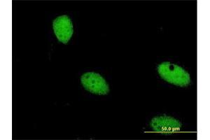 Immunofluorescence of monoclonal antibody to ZNF274 on HeLa cell. (ZNF274 Antikörper  (AA 420-530))