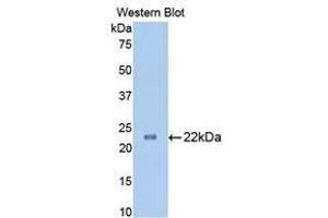 Western Blotting (WB) image for anti-Slit Homolog 1 (SLIT1) (AA 611-791) antibody (ABIN1860575) (SLIT1 Antikörper  (AA 611-791))