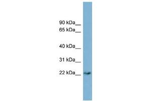 WB Suggested Anti-PERP  Antibody Titration: 0. (PERP Antikörper  (Middle Region))
