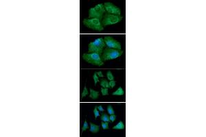ICC/IF analysis of TXNRD1 in Hep3B cells line, stained with DAPI (Blue) for nucleus staining and monoclonal anti-human TXNRD1 antibody (1:100) with goat anti-mouse IgG-Alexa fluor 488 conjugate (Green). (TXNRD1 Antikörper)