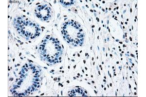 Immunohistochemical staining of paraffin-embedded breast tissue using anti-BRAF mouse monoclonal antibody. (BRAF Antikörper)