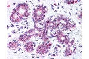 Anti-Estrogen Receptor antibody IHC of human breast. (ITIH1 Antikörper  (AA 410-592))